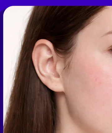 Da nhạy cảm, dễ ửng đỏ